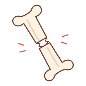 Ilustración de hueso con fractura