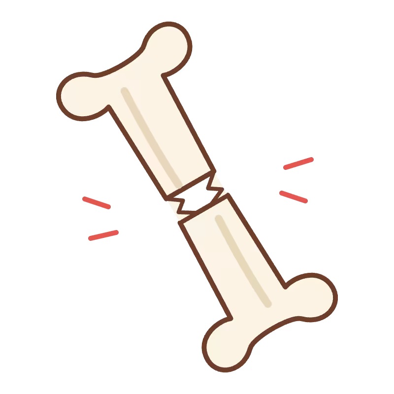 Ilustración de hueso con fractura